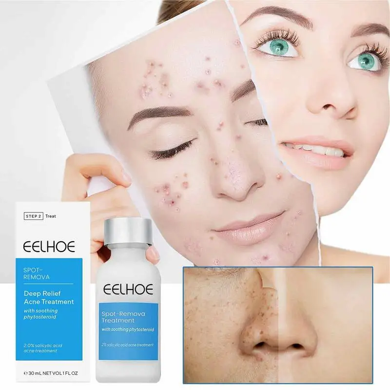 

Pimple Remover Face Pore Shrinking Serums 1 Fl Oz Spot Repair Fluid Reduce Blemish Spot Pimple Whitehead Skin Care Lotion