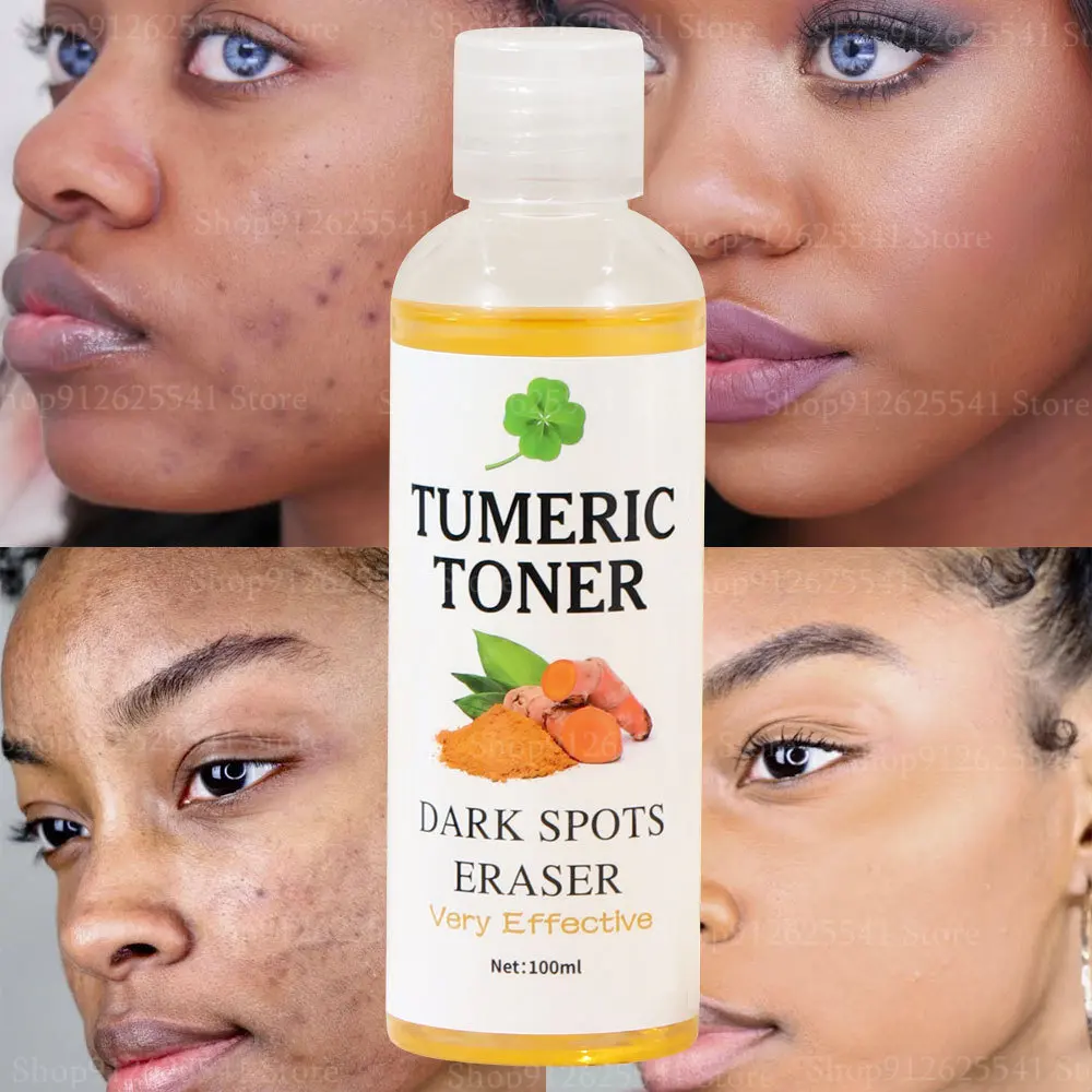 R Natural Tumeric Facial Strong Lightening Toner For Black S