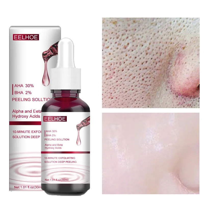 

30ml Shrink Pores Face Salicylic Acid Serum Exfoliating Acne Remove Blackhead Brighten Whitening Fade Lines Skin Care Essence