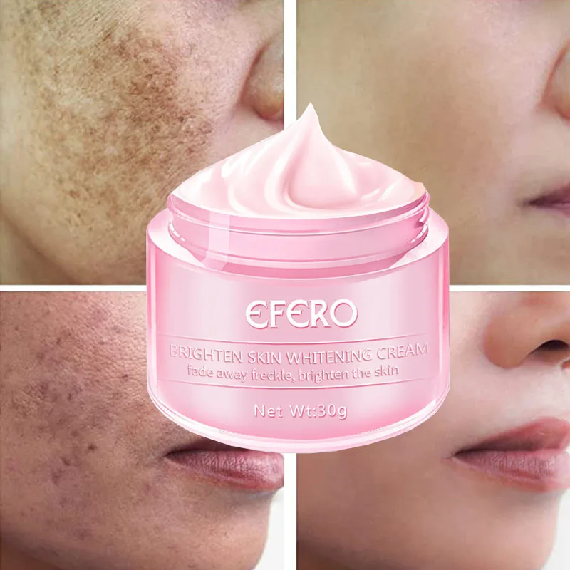 

Effective Whitening Cream Freckle Cream Fade Acne Scars Remove Dark Spots Melanin Pigmentation Melasma Anti-Aging Brighten Skin