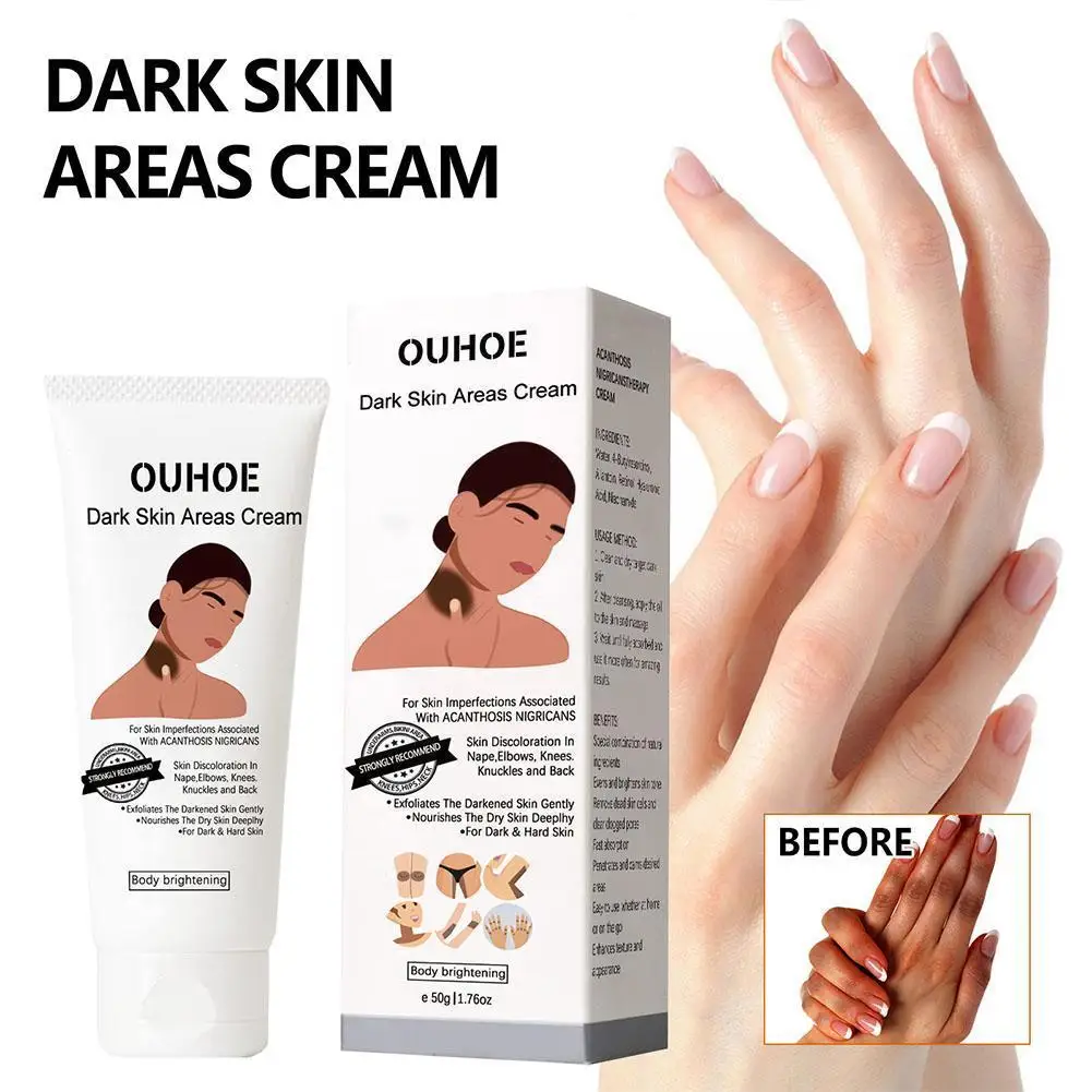 

Whitening Cream For Intimate Area Dark Skin Underarm Neck Inner Elbow Remove Armpit Knees Black Spots Bleach Hot Y5T6