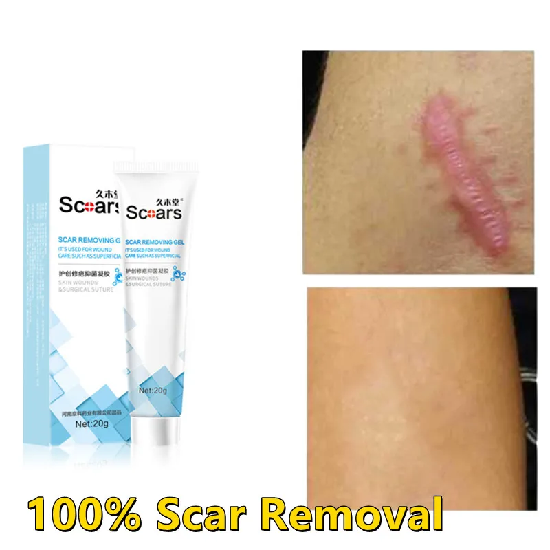 Wound Scar Removal Cream Gel Scar Desalinization And Removing Ling Scar Keba Scar Removal Herbal Scar Repair Cream 20g