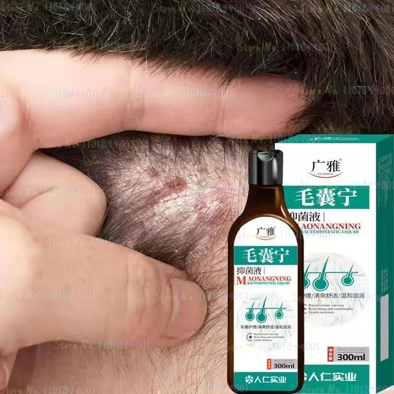 Scalp Soothing Mites Maoyan Nangning Shampoo Wholesale Anti-dandruff Anti-itching Shampoo Scalp Ringworm Shampoo Repair Damage