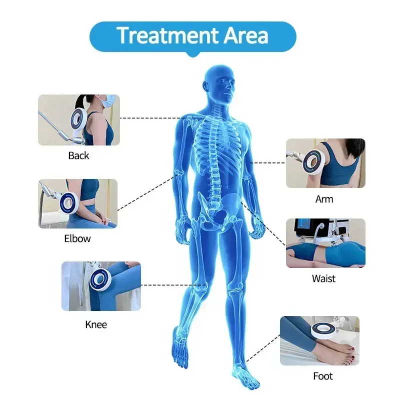 2024 physio magneto plus лазерная терапия 808 нм супертрандукционный импульт