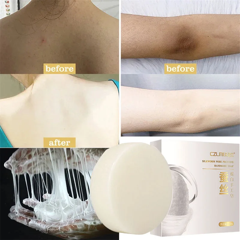 

Body Whitening Soap Chicken Skin Removal Underarm For Knees Bleaching Soap Dark Spot Dead Skin Treatment Moisturizing Body Care