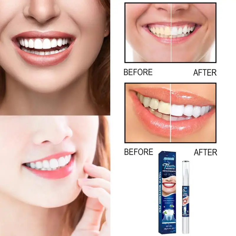 

Teeth Whitener Fast And Effective Teeth Stain Remover Mint Flavor Teeth Whiten Applicator Dental Plaque Fresh Breath for Coffee