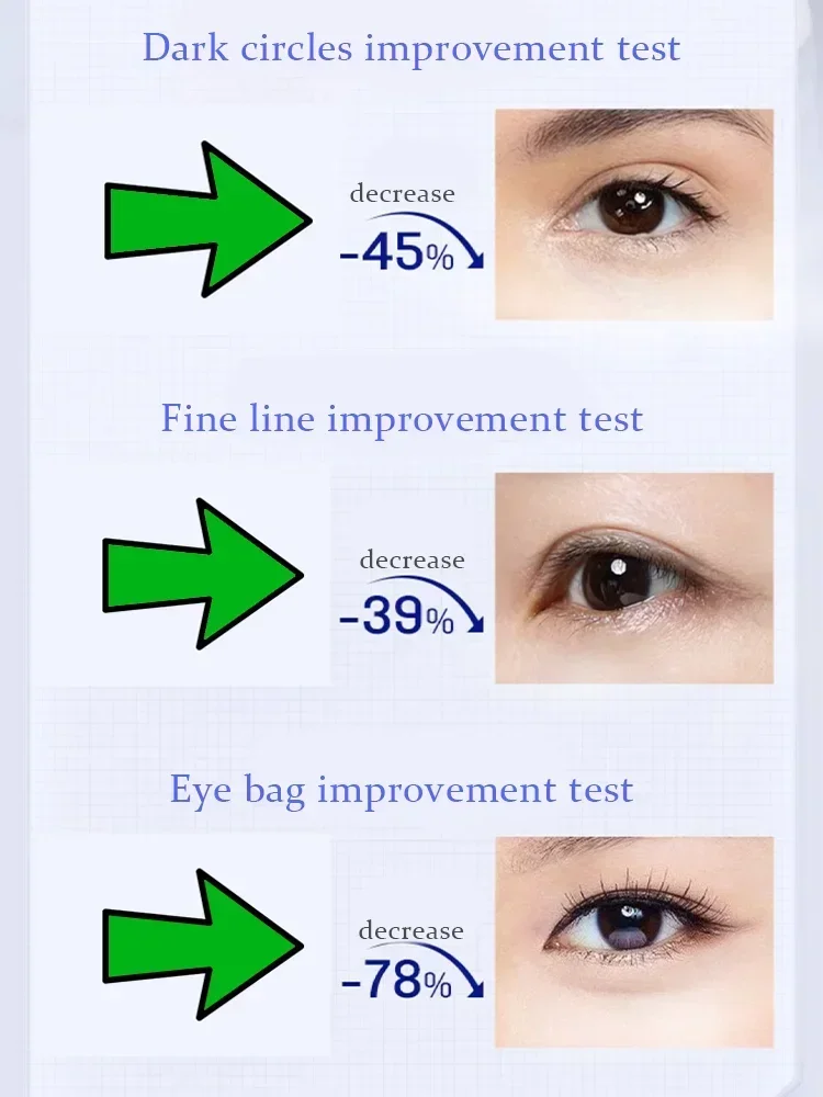 Крем для области вокруг глаз подтягивающий укрепляющий удаляет отеки и морщины