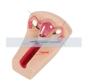 Модель внутриуточечного противозачаточного устройства для женщин обучающий