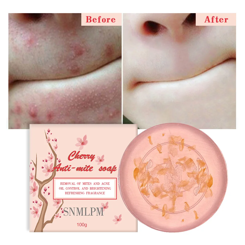 1pcs 100g Handmade Petal Soap Facial Body Cleansing Acne Mites Sakura Mite Removal Soap Free Shipping