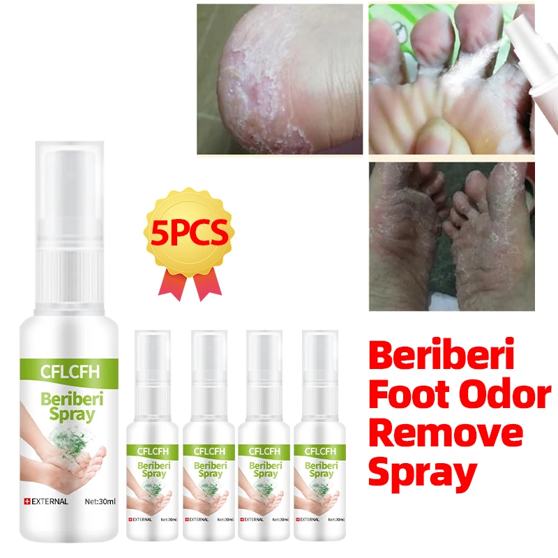 5CPS средство для удаления грибка ног спрей бери-пота спортсмены лечение лекарство