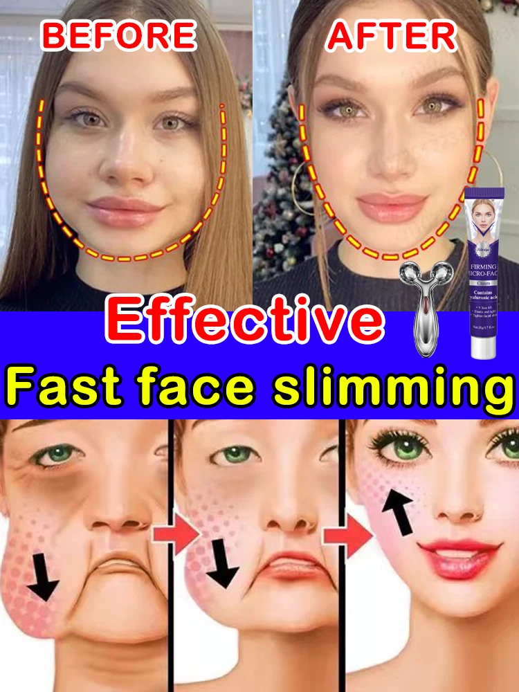 Удаление двойного подбородка