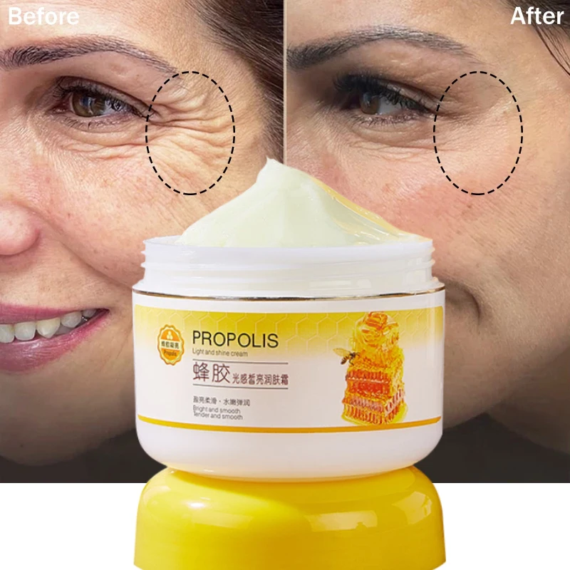 

Skin Whitening Moisture Nourish Fade Fine Lines Anti-Aging Bright Natural Propolis Face Cream Remove Black Spots Compact 100g