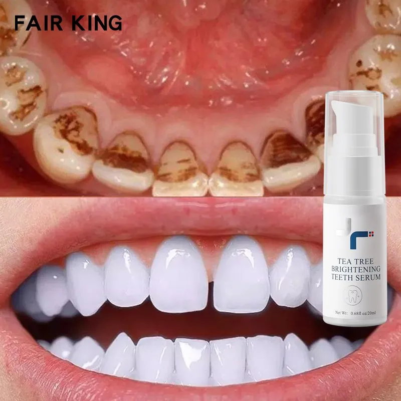 

Teeth Cleansing Whitening Mousse Tooth Removes Stains Essence Oral Hygiene Dental Mousse Cleaning Tools Toothpaste For Adults