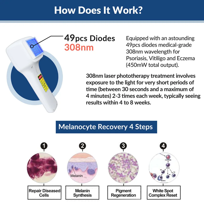 ZJKC 308nm Экксимерная система Фотодинамическая терапия УФ-световое устройство для