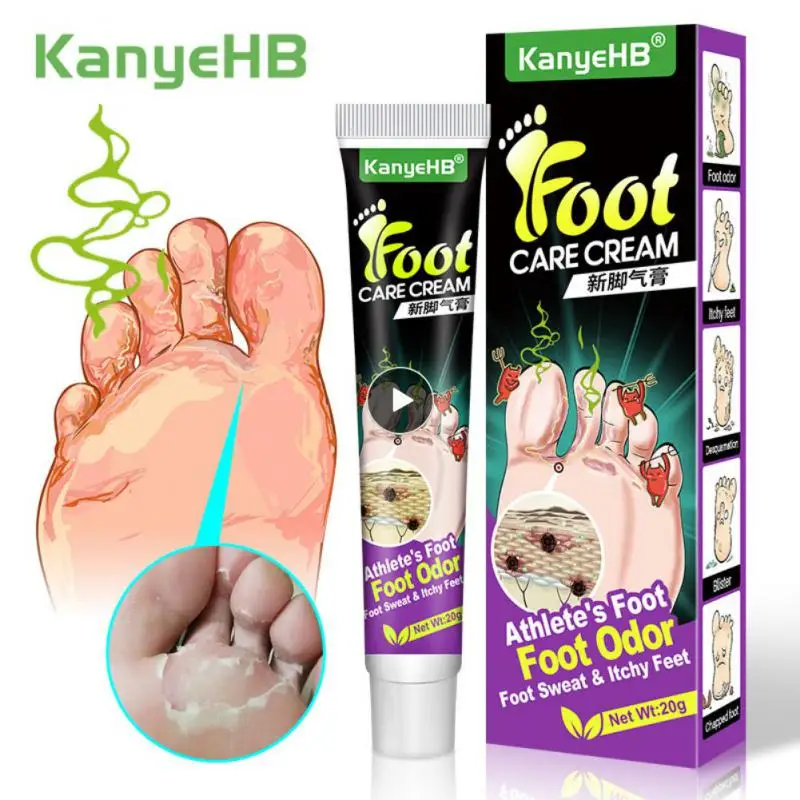 

20g Athlete's foot cream medicated foot skin external use care cream anti-fungal anti-inflammatory relieves itching