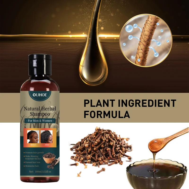 

100ml Scalp Cleansing Shampoo Dandruff Seborrheic Hair Follicle Antibacterial Antipruritic Mite Oil Control Psoriasis Acne