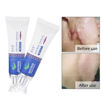 30g surgery acne scar removal cream repair gel facial acne stretch marks smoothing moisturizing burning scars body skin care