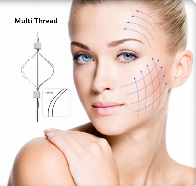 Косметическая хирургия для подтяжки кожи молдинг ПДО рыбья кость лица и тела с