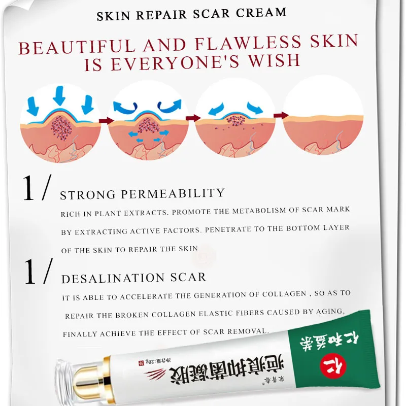 Acne Scar Removal Face Cream Spots Pigmentation Corrector Whitening Anti Stretch Marks Repair Gel Skin Care |