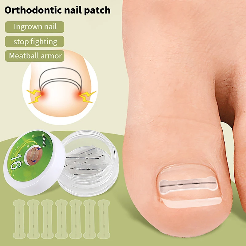 

10Pcs Ingrown Toenail Corrector Orthodontic Nail Patch Toe Nail Grooves Treatment Elastic Patch Straightening Clip Pedicure Tool