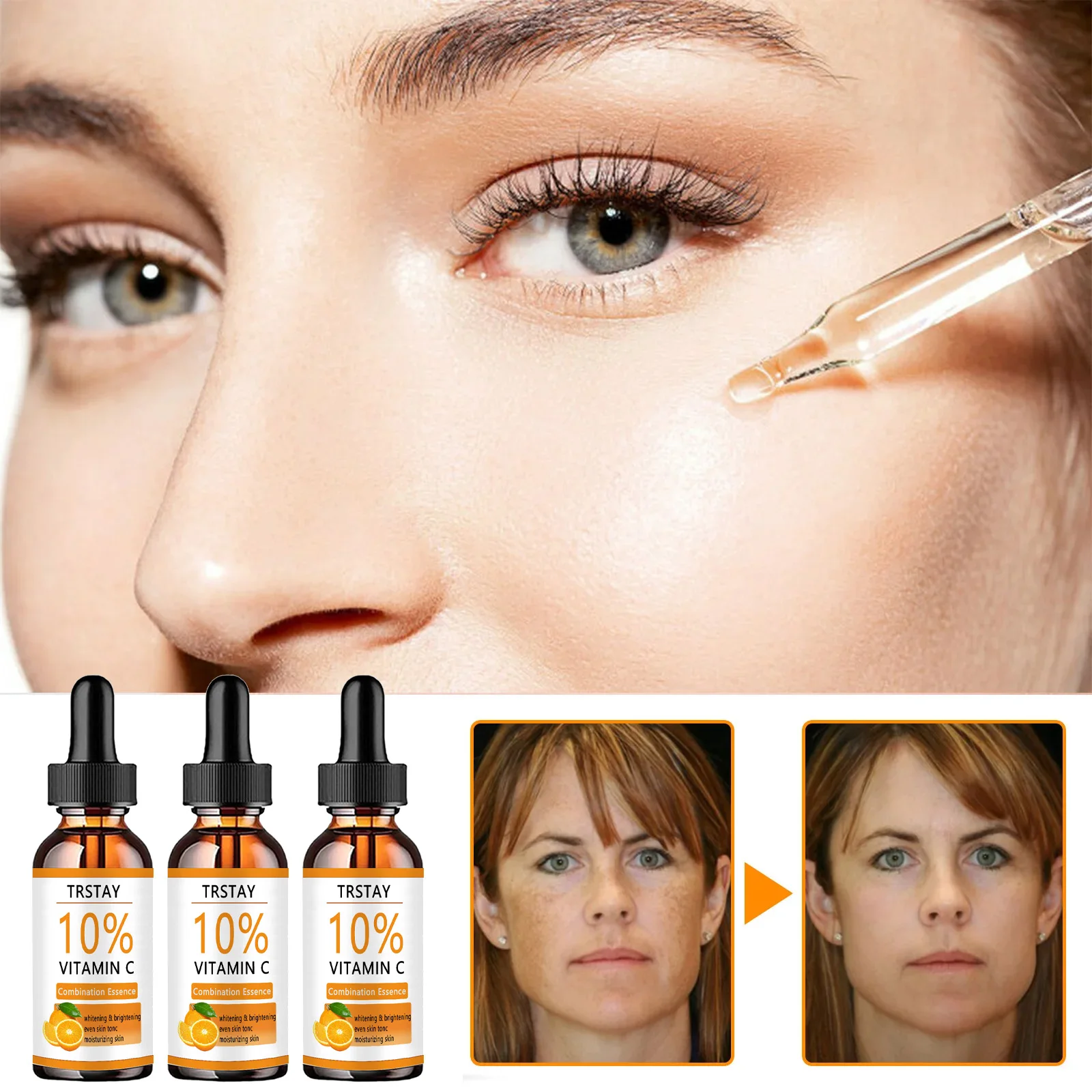 Отбеливающая сыворотка с гиалуроновой кислотой TRSTAY-глубоко увлажняет и питает