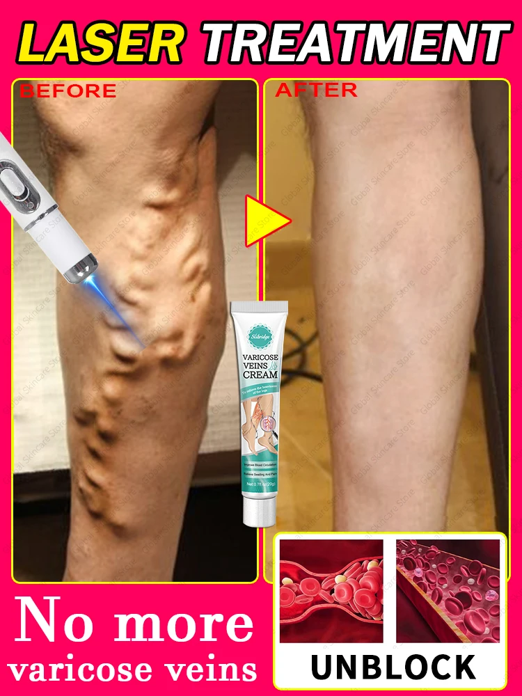 синий лазер Promova Sangue