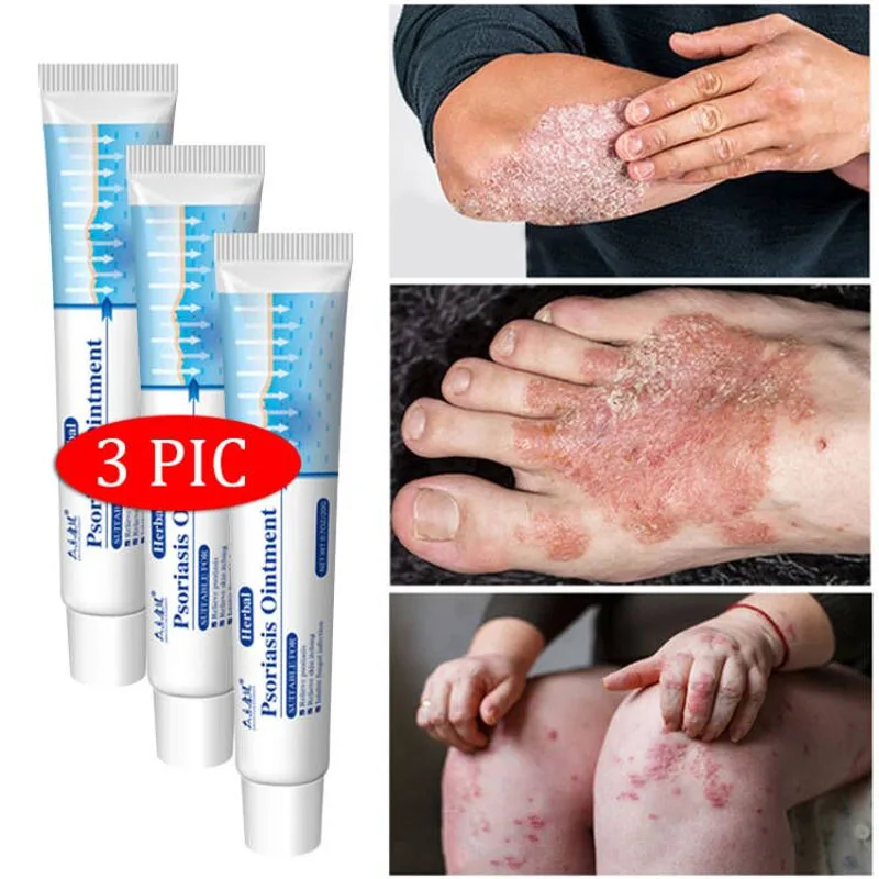 

Psoriasis Ointment Antibacterial Cream Herbal Treatment Fungus Eczema Anti-itch Relief Rash Urticaria Desquamation Body Care