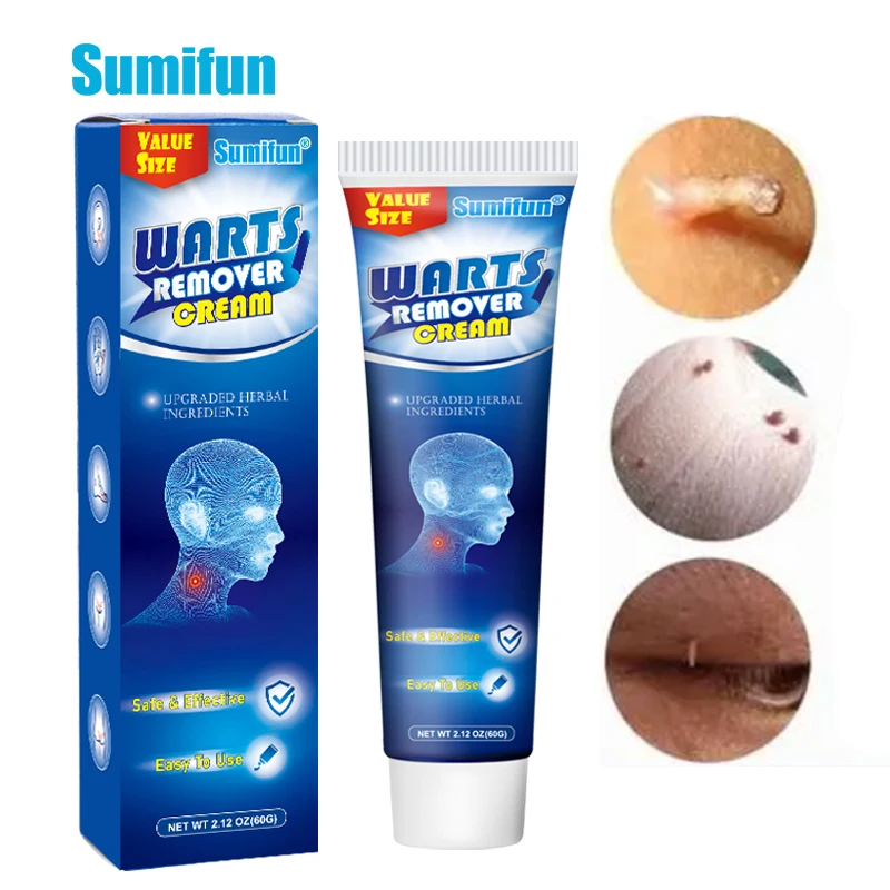 

Sumifun 60g Wart Corn Remover Cream Skin Tag Remover Cream Genital Warts Moles Papillomas Treatment Herbal Skin Care Ointment
