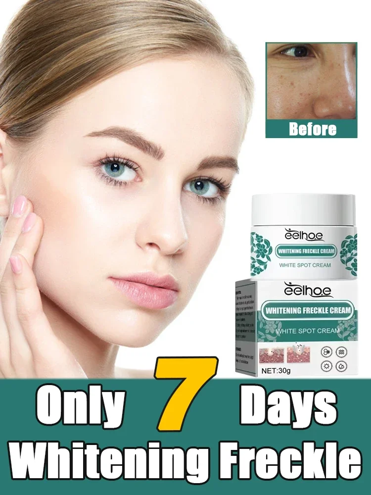 Осветление темной кожи отбеливающий крем от темных пятен удаление веснушек
