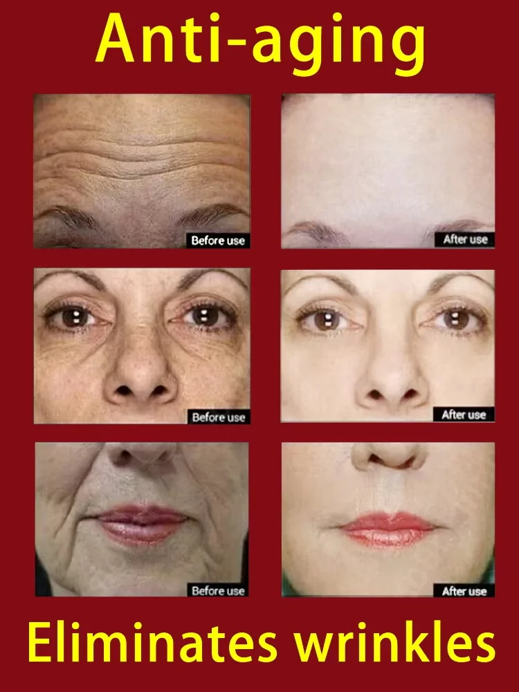 Крем для удаления морщин с ретинолом исчезающий крем лица глаз тонкая линия