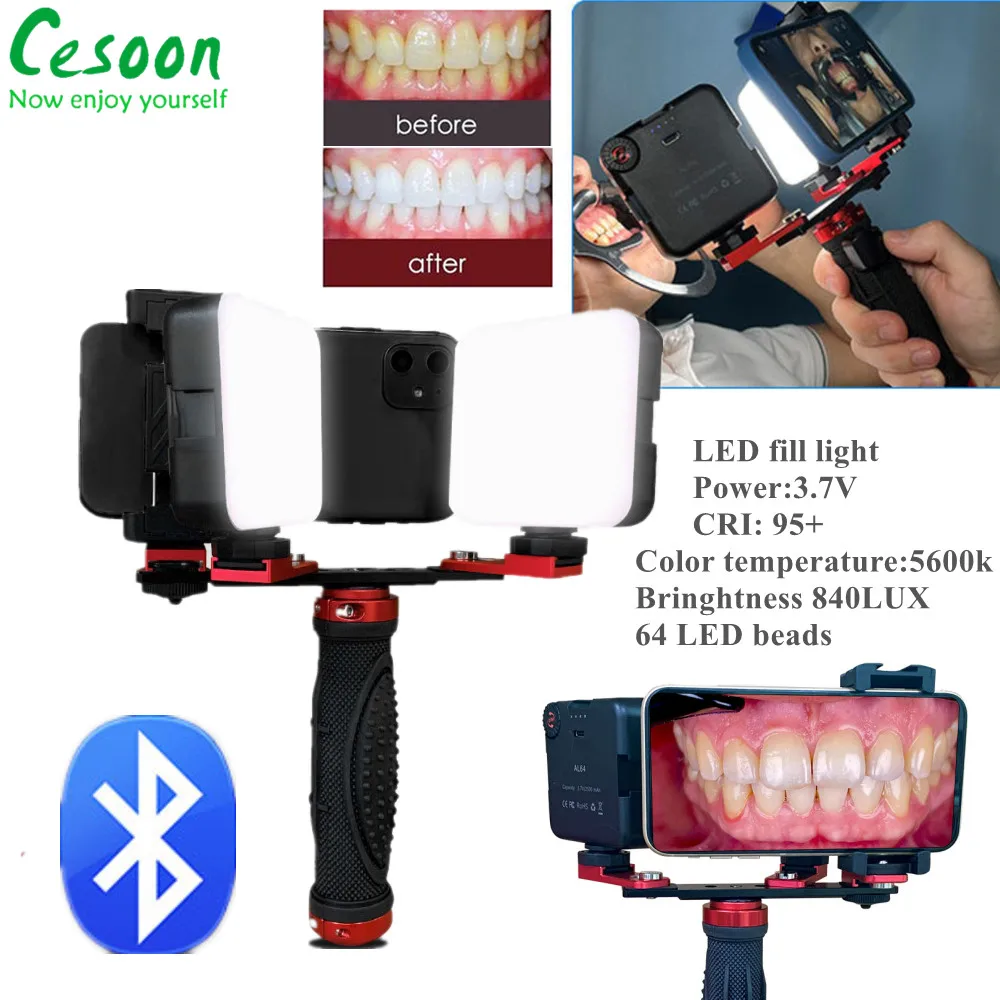 

Портативная лампа для стоматологической фотосъемки