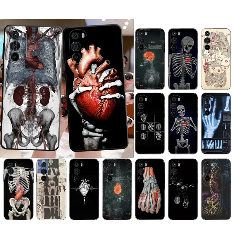 

Organ Skeleton Skull Brain Case for Moto E22i E32 E32S E13 E40 E30 E20 Edge X30 20 Lite 20Pro 30 Neo Ultra Fusion E7Power Plus