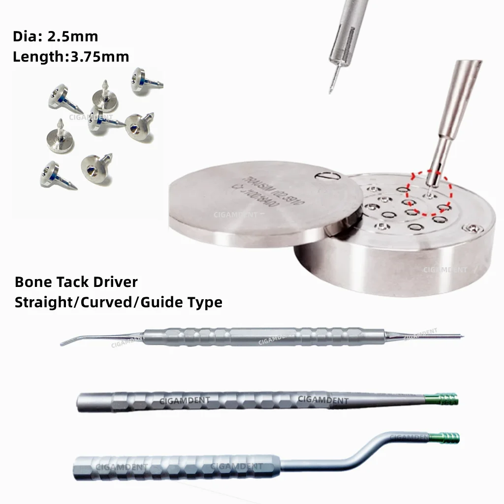 

Титановые штифты-держатели Dental Bone Tack для фиксации мембраны