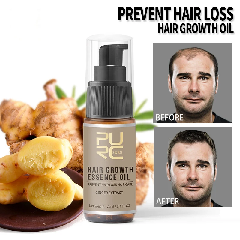 20ml Hair Growth Essential Oil Fast Hair Growth Spray Anti Hair Loss Thinning Dry Scalp Care Beauty Hair Care Products PURC