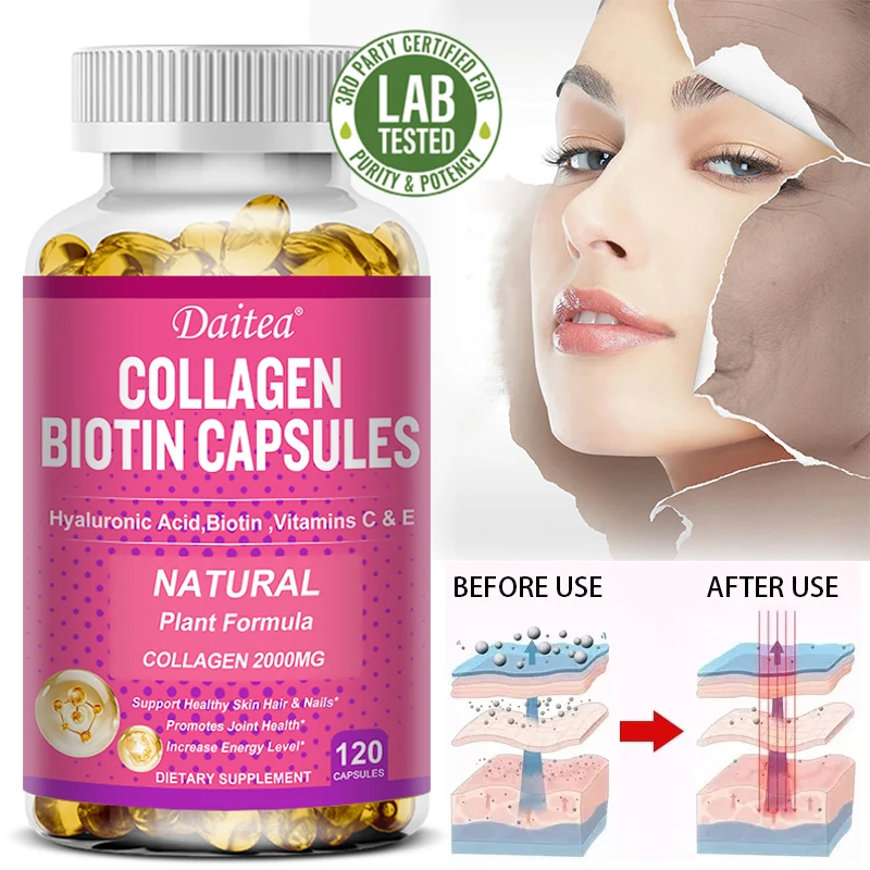 

Collagen Biotin Capsules Vitamin C Supports Skin, Hair and Nails Promotes Joint Health and Increases Energy Levels