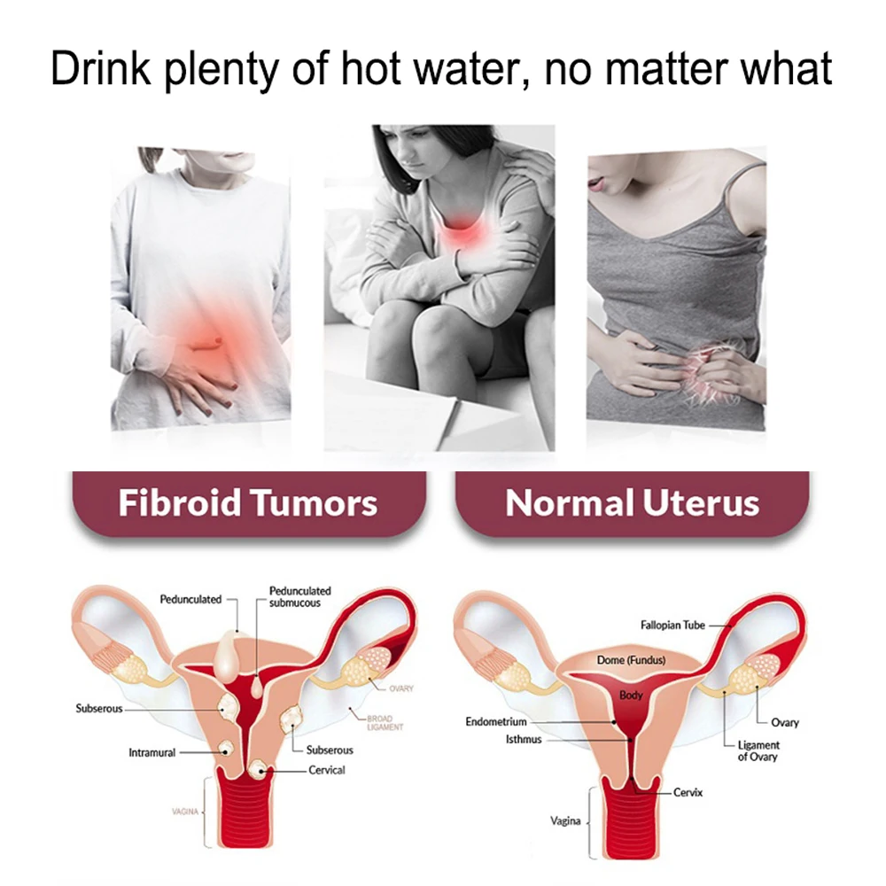 20 пакетов лидер продаж детоксикационный чай для матки 100% натуральный здоровья Laso