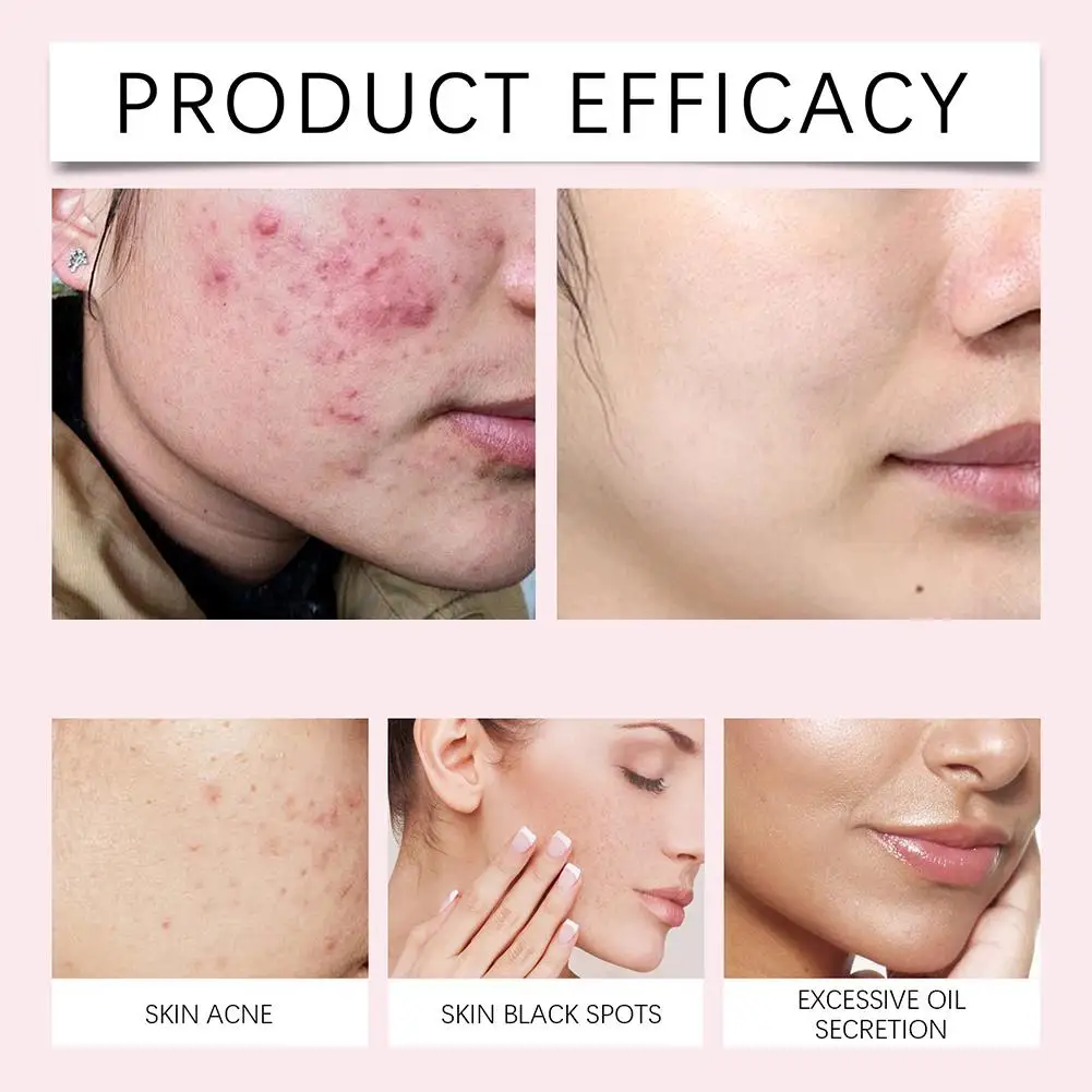 40 шт. очищающие подушечки для лица с куркумой и койевой кислотой