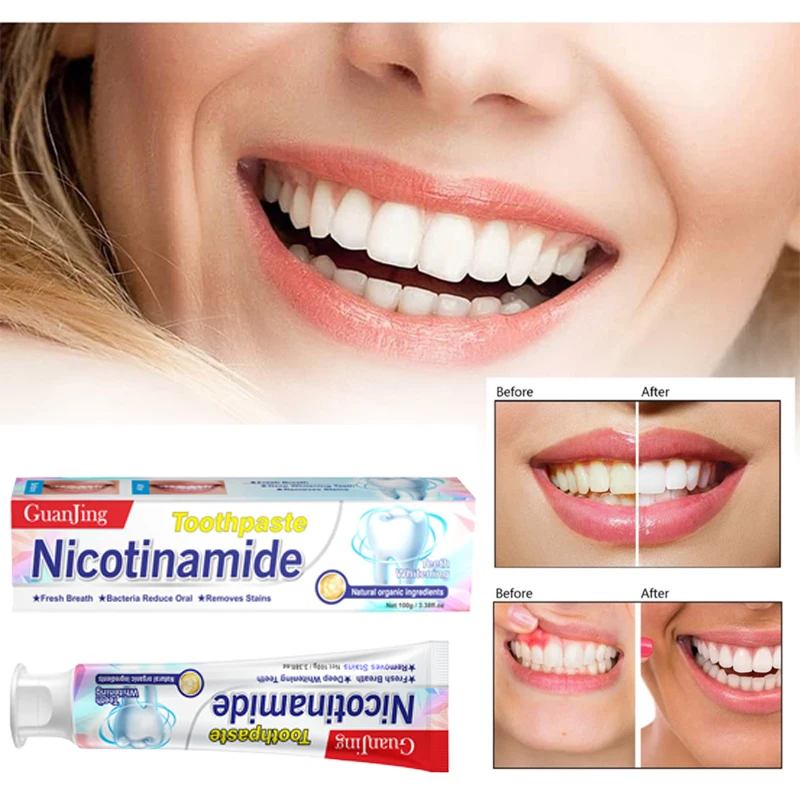 

Teeth Whitening Toothpaste Nicotinamide Gum Tartar Remover Fresh Breath Oral Hygiene Deep Cleansing Instant Smile Dental Tools