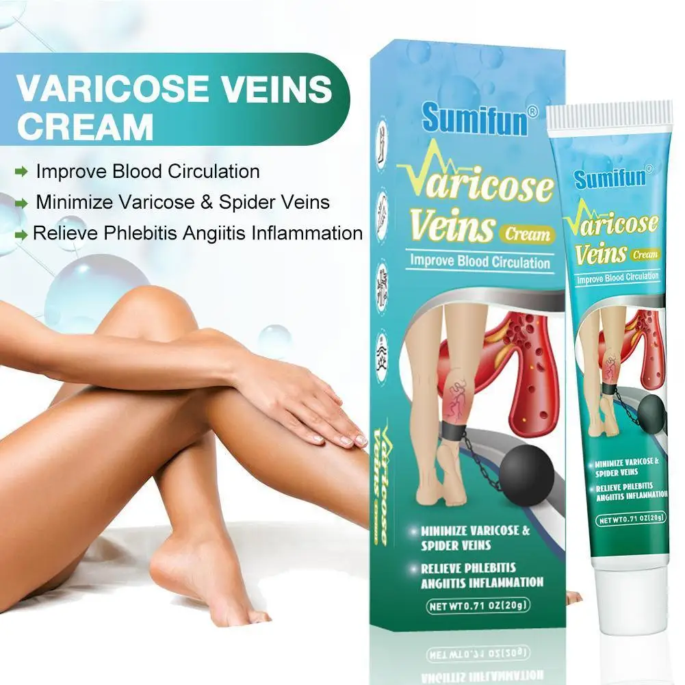 

20g Treatment For Varicose Veins Herbal Medicine For Varicosity Angiitis Removal Phlebitis Leg Veins Pain Ointment Body Care