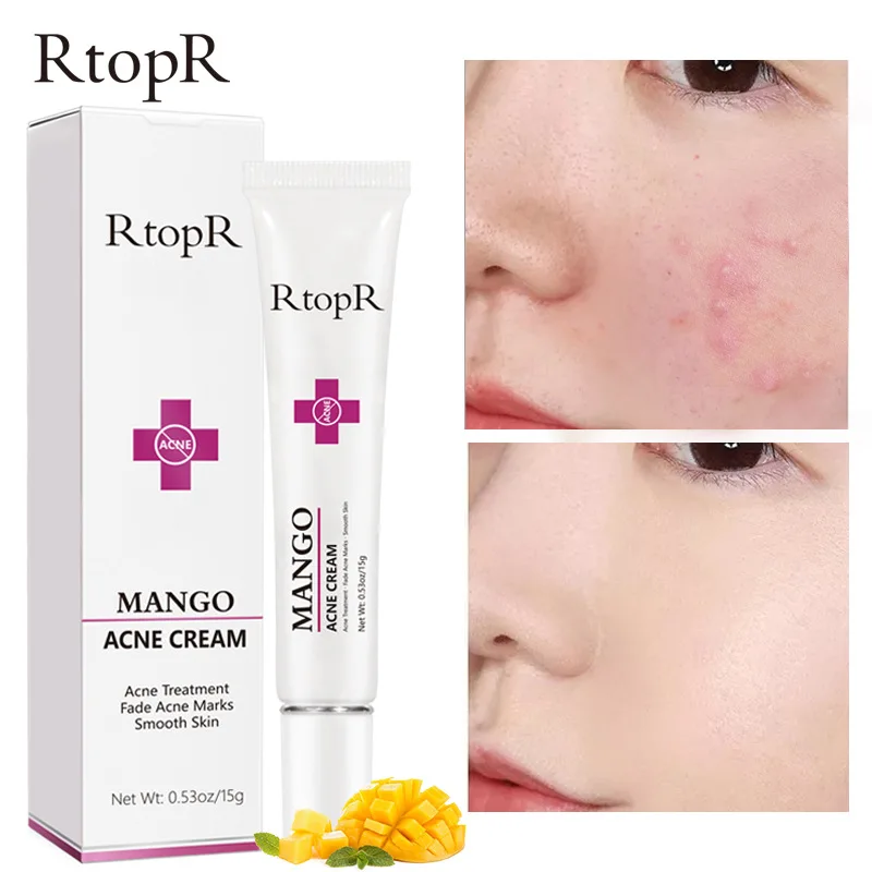 

5PCS RtopR Mango Repair Acne Treatment Face Cream Blackhead Repair Shrink Pores Scars Whitening Moisturizing Skin Care Cosmetics