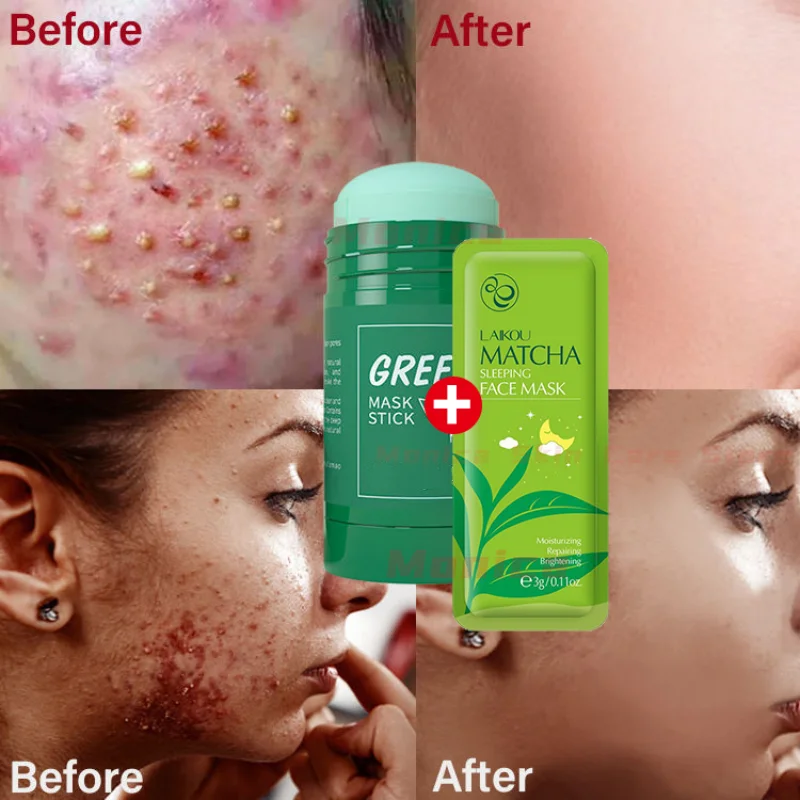 Repair Acne Mud Mask Face Clean Clay Stick Pore Shrinkage Tr