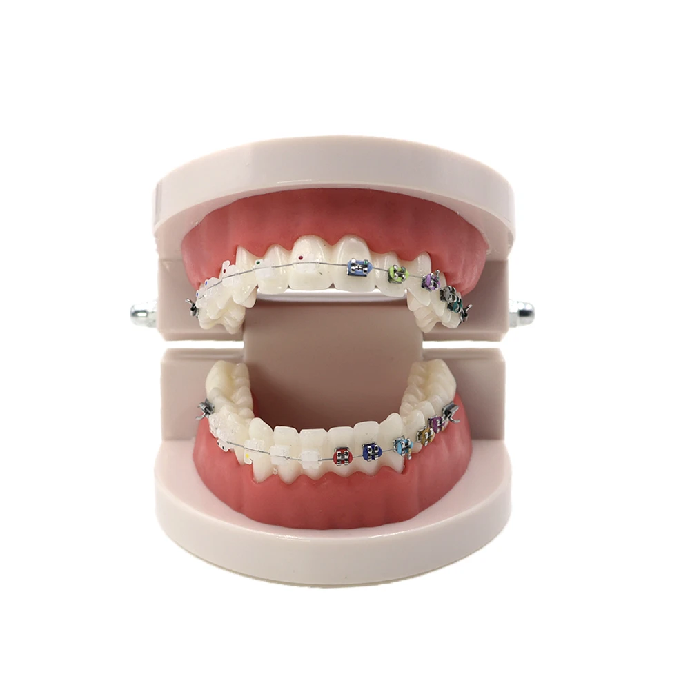 

Стоматологическая Ортодонтическая обучающая модель зубов с кронштейнами, дуговая проволока, букальная трубка