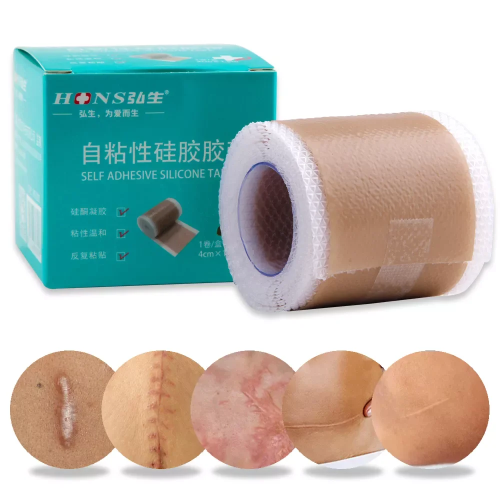 

4x50cm Silicone Scars Patch Wounds Band Remove Acne Burn Scar Treatment Cover Ear Correctors Efficient Repair Damaged Skin Sheet