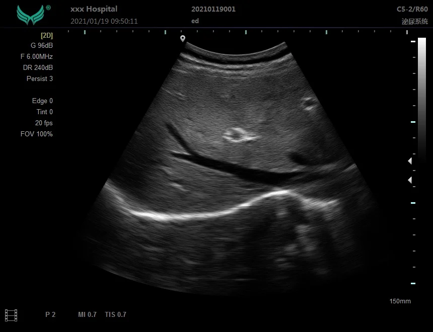 Ноутбук YD-P20 B/W ультразвуковая диагностическая система портативная цена