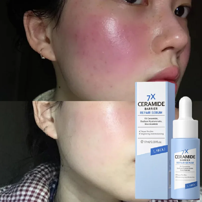 

Ceramide Redness Relieving Serum Strengthening Skin Barrier Relieves Dryness Moisturizing Essence Hydration Sensitive Skin Care