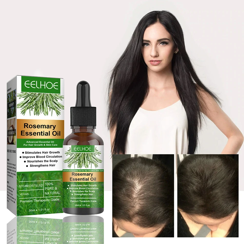 

Sdattor 30ml Hair Growth Serum Rosemary Anti Hair Loss Oil Control Hair Regrowth Essential Oil Scalp Repair Hair Growth Essence