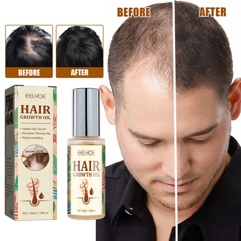

Hair Growth Oil Hair Growth Products Fast Effective Anti-Hair Loss Smoothing Beauty Scalp Care Plant Essence Oil Hair Care 50ml