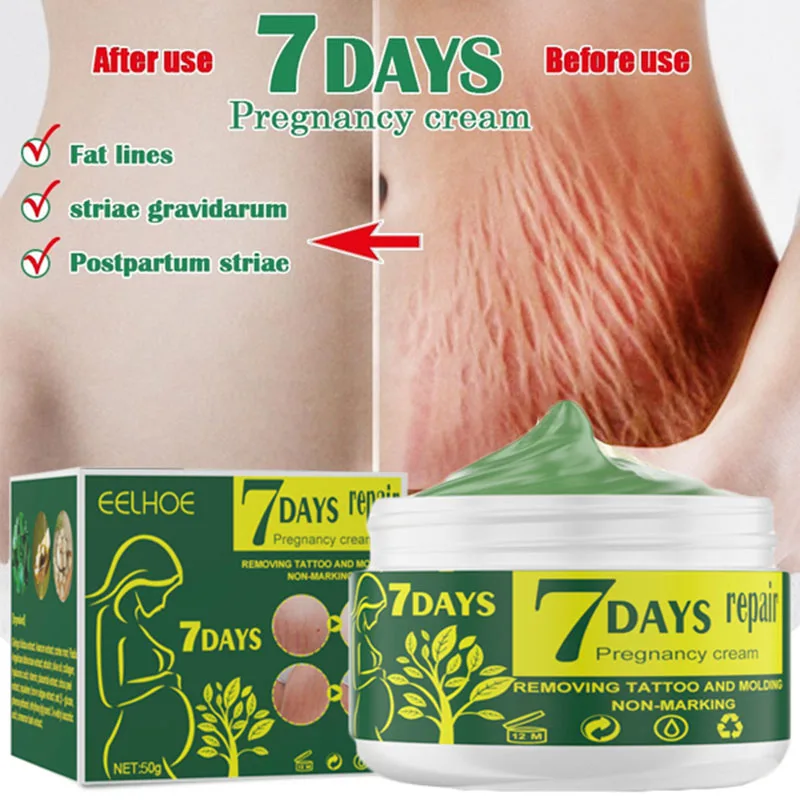 

Pregnancy Repair Cream Stretch Mark Removal Removal Acne Scar Stretch Marks Cream Fat Striae Gravidarum Treatment Body Creams