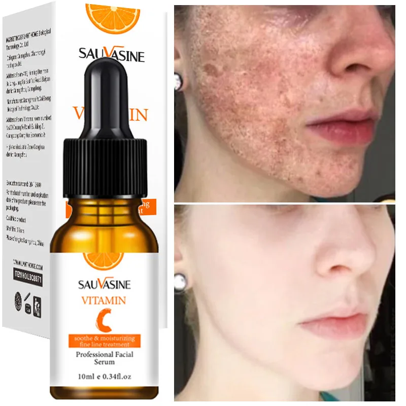 

Vitamin C Face Serum Pore Shrinking Whitening Anti Dark Spots Hyaluronic Acid Facial Essence Brightening Moisturizing Skin Care