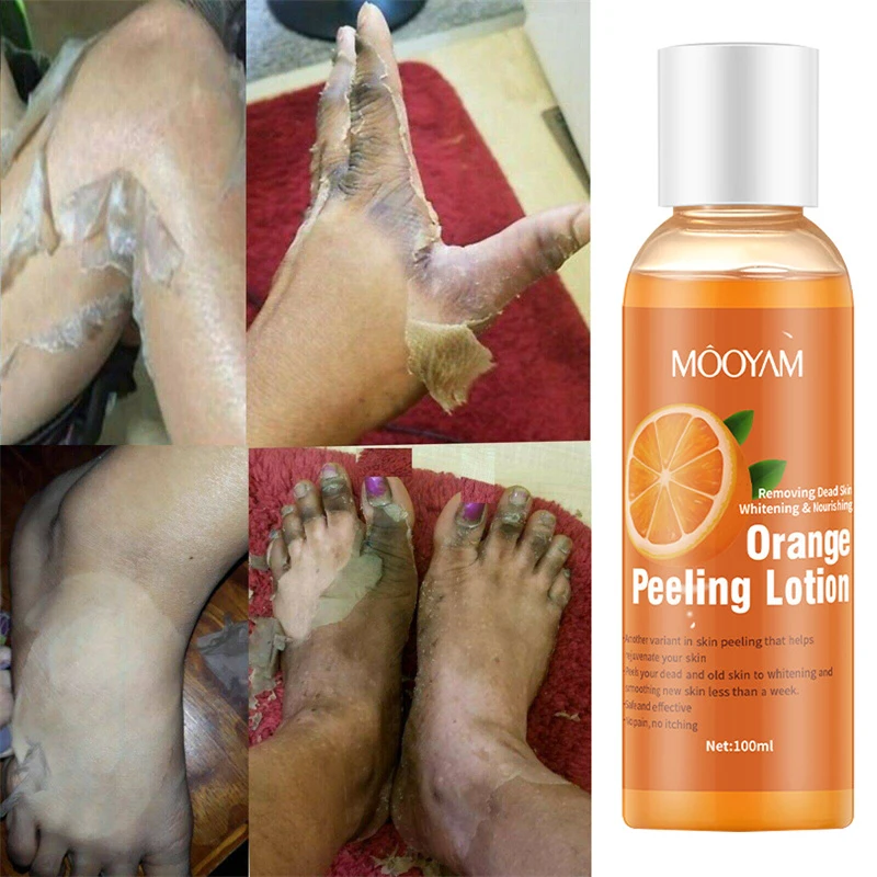 

Orange Peeling Lotion Body Whitening Exfoliating Oil Knee Underarm Dark Skin Body Moisturizing Essence Skin Care Products 100ml